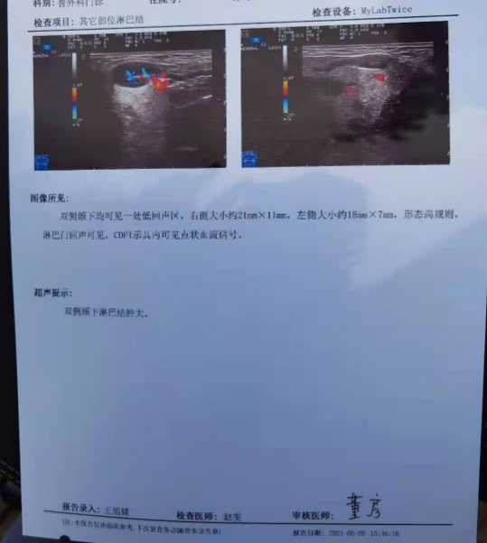 164222iic2uyc9lfsfccsm.jpg