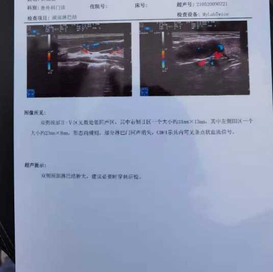 164222izpddpd9m2d8rp9p.jpg
