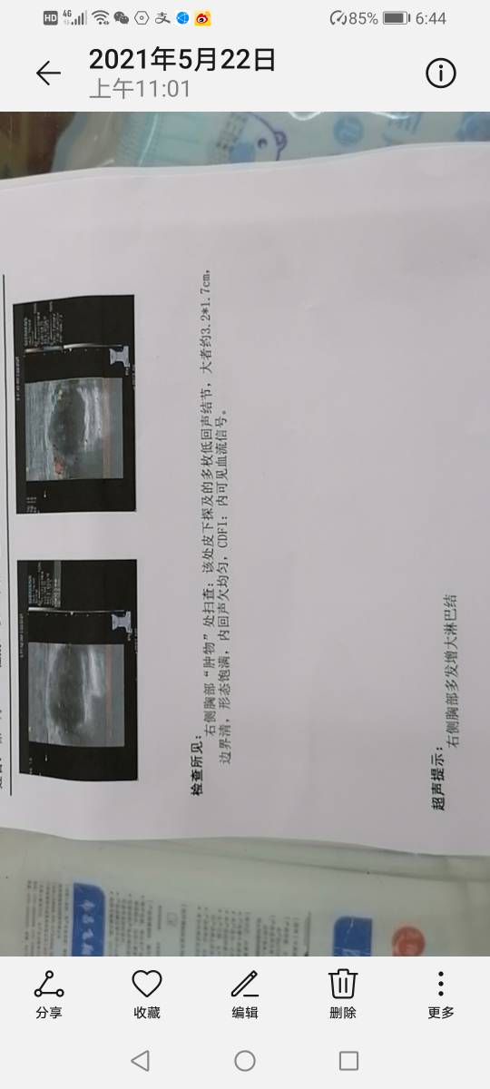 184454v5ls885ukff9z559.jpg