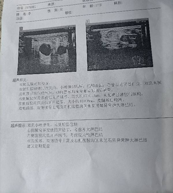 152528wb6fst5eylic5ce1.jpg