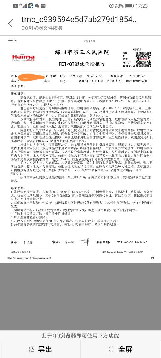 135929us1rcwe1bbbfscrp.jpg