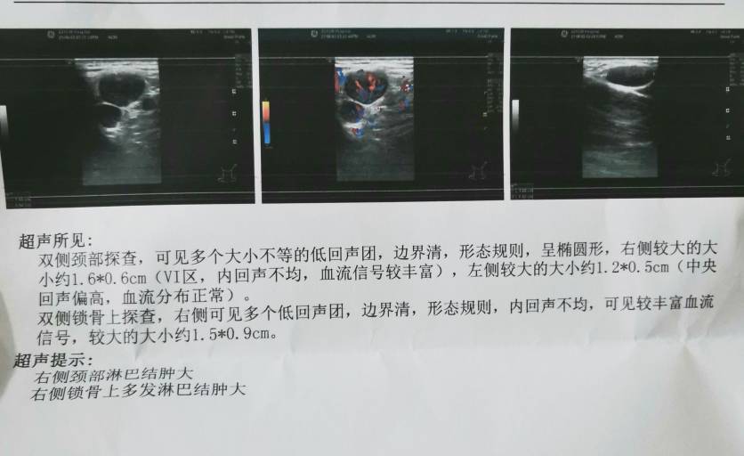 171304kcct6316kckagz1q.jpg