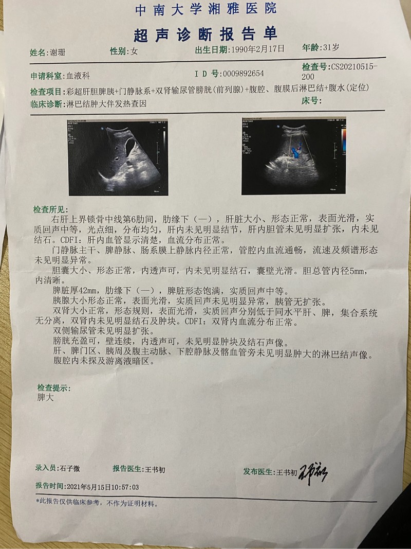 172314nn4mdl3lc49600xi.jpg