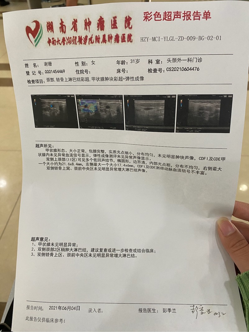 172317vos8zoh8s8sco8cn.jpg
