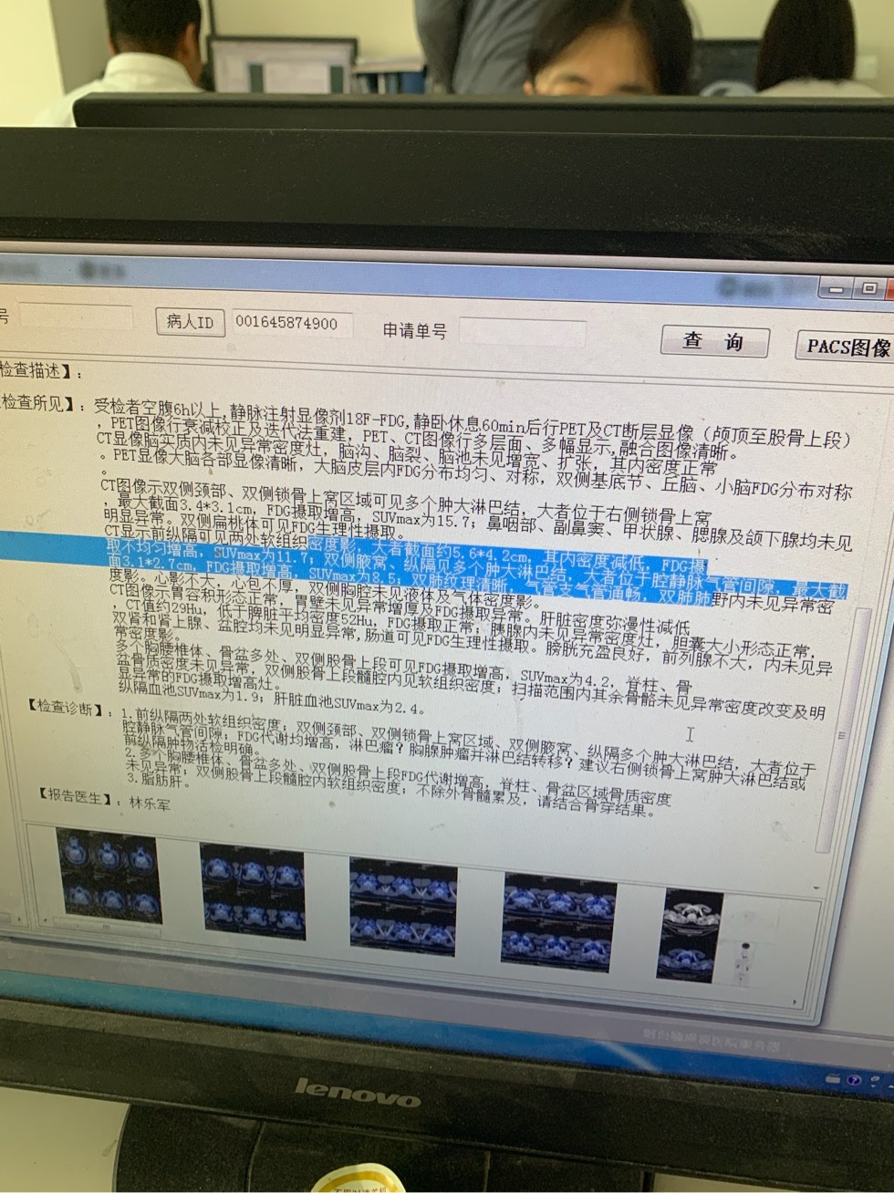 145457ys69efcw96j0mfbi.jpg