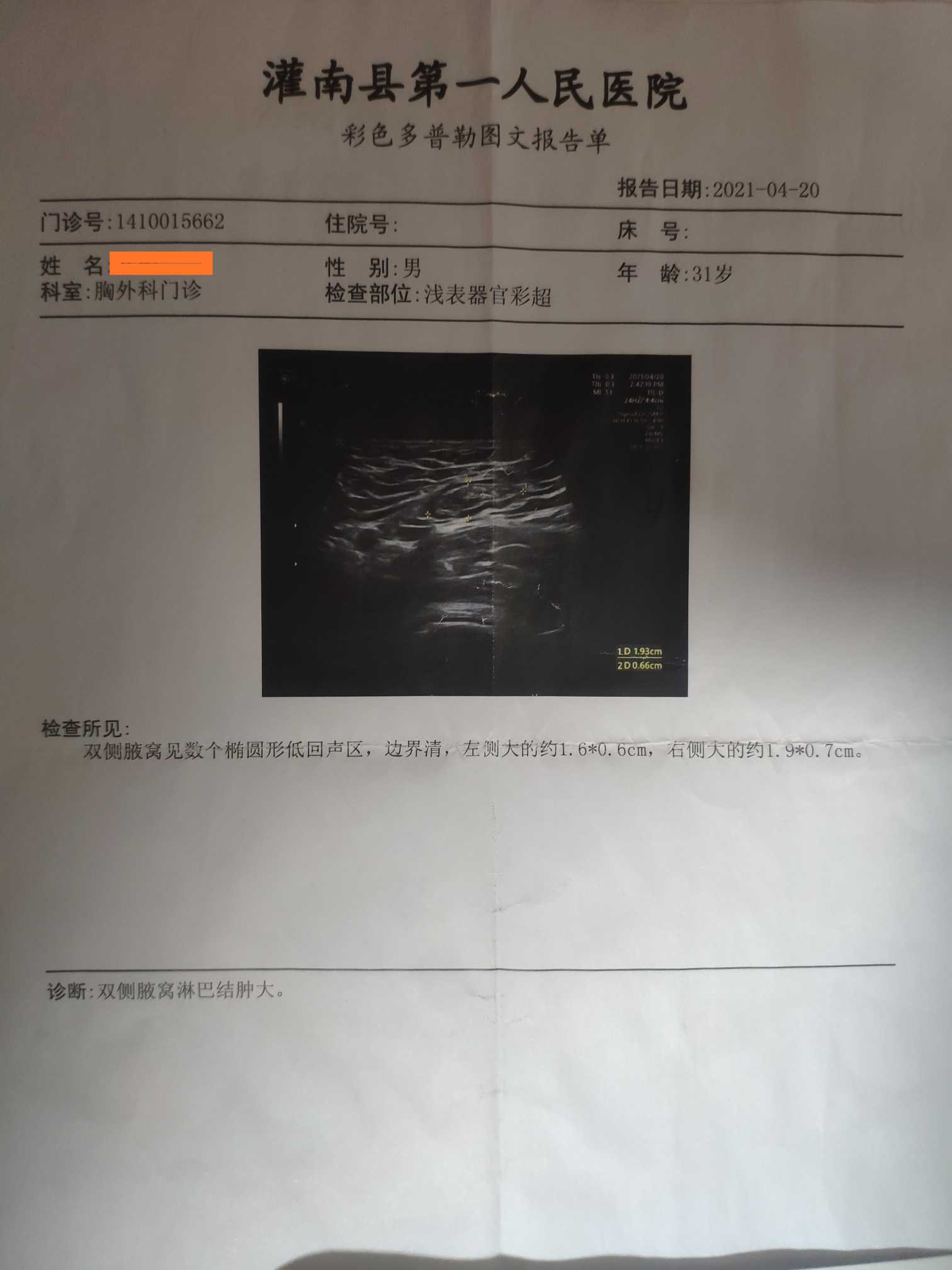 145241ldg1ygrzo7qnzccd.jpg