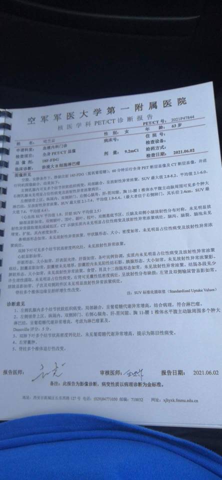 210754a33j003di4jbb637.jpg