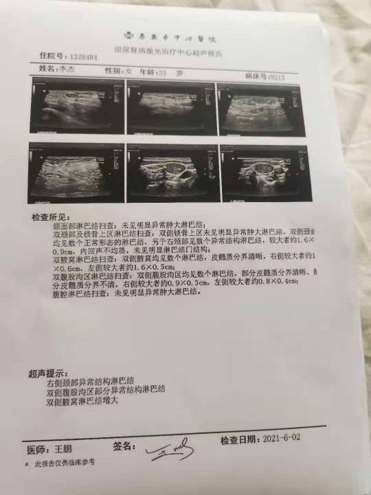 211815ghpk9hl5hk544p4h.jpg