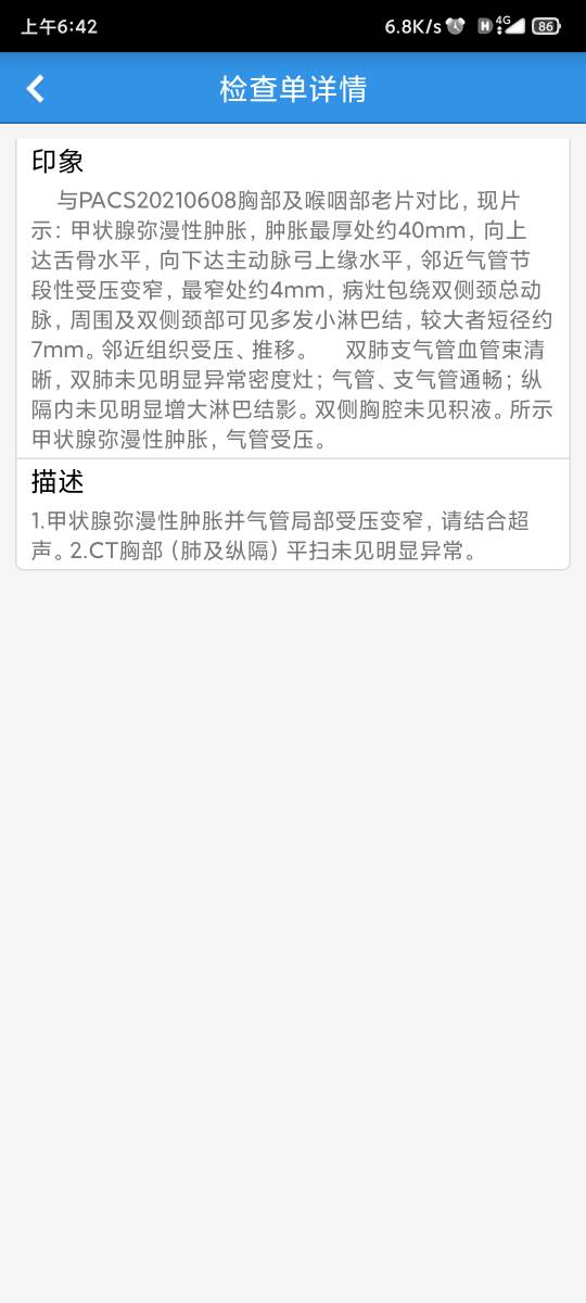 150828md3356pd444dvmv5.jpg
