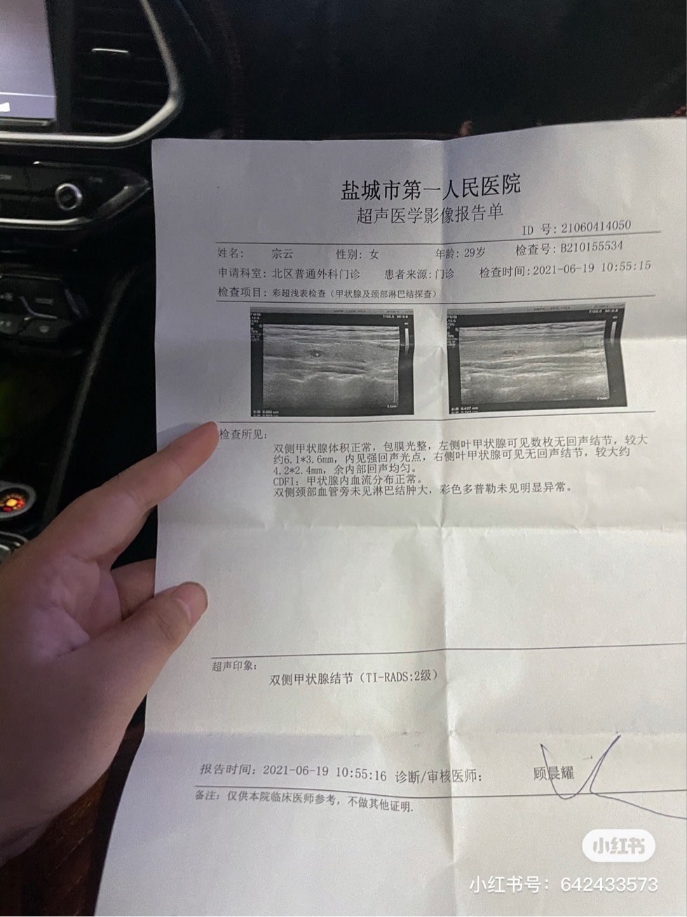 135514ht3a8aeaztg0fn29.jpg