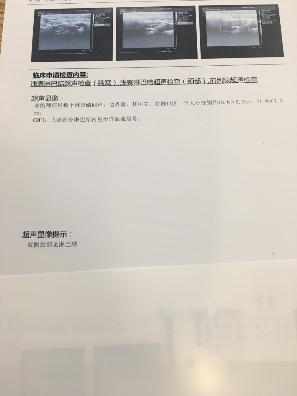 124403ibuzb03ebk3zkhue.jpg