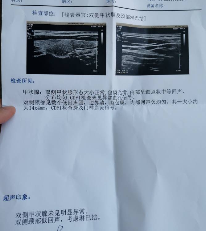184814c914qidx1hhx4d56.jpg