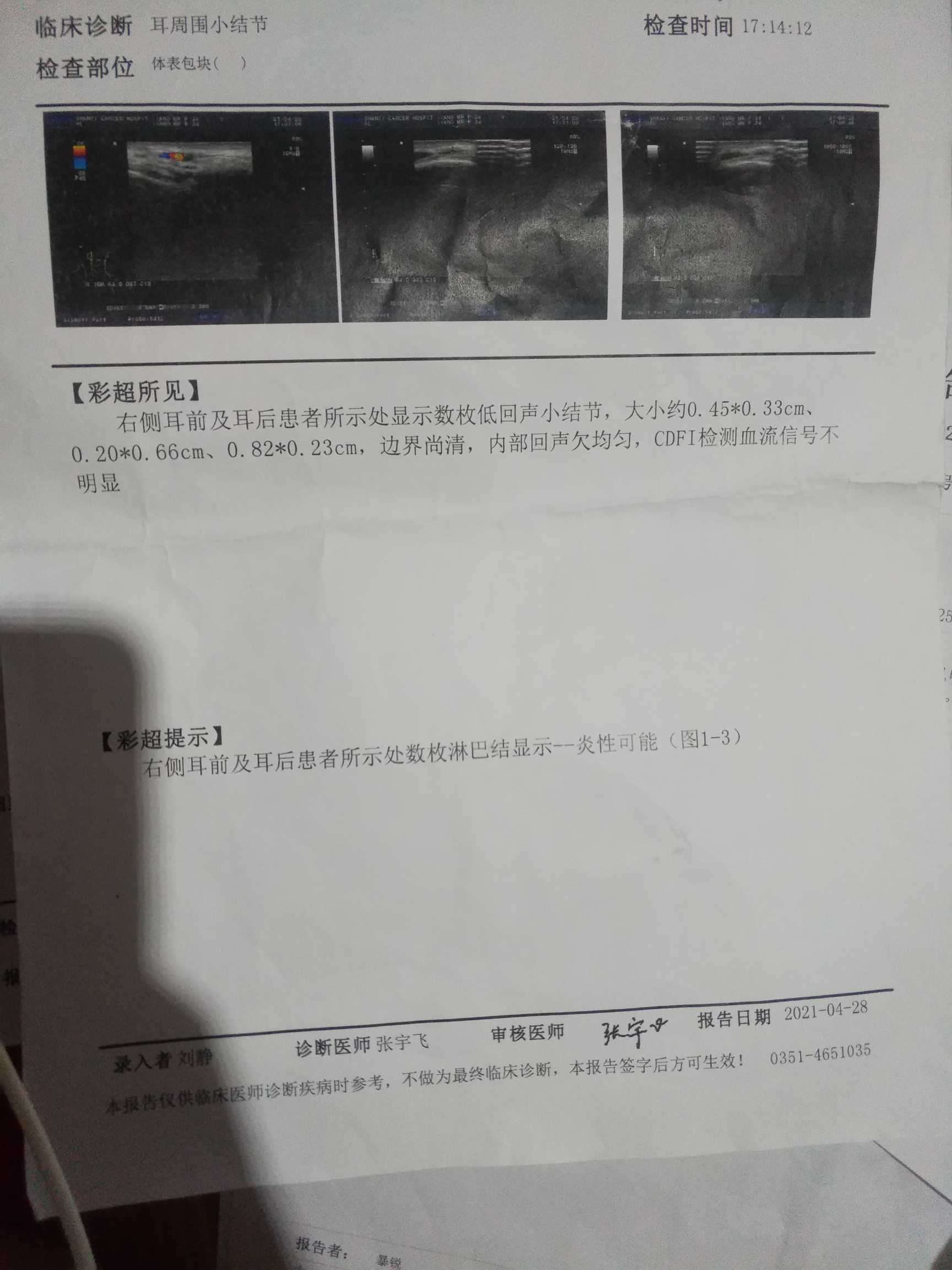 220935qzbfk36411rcr6cc.jpg