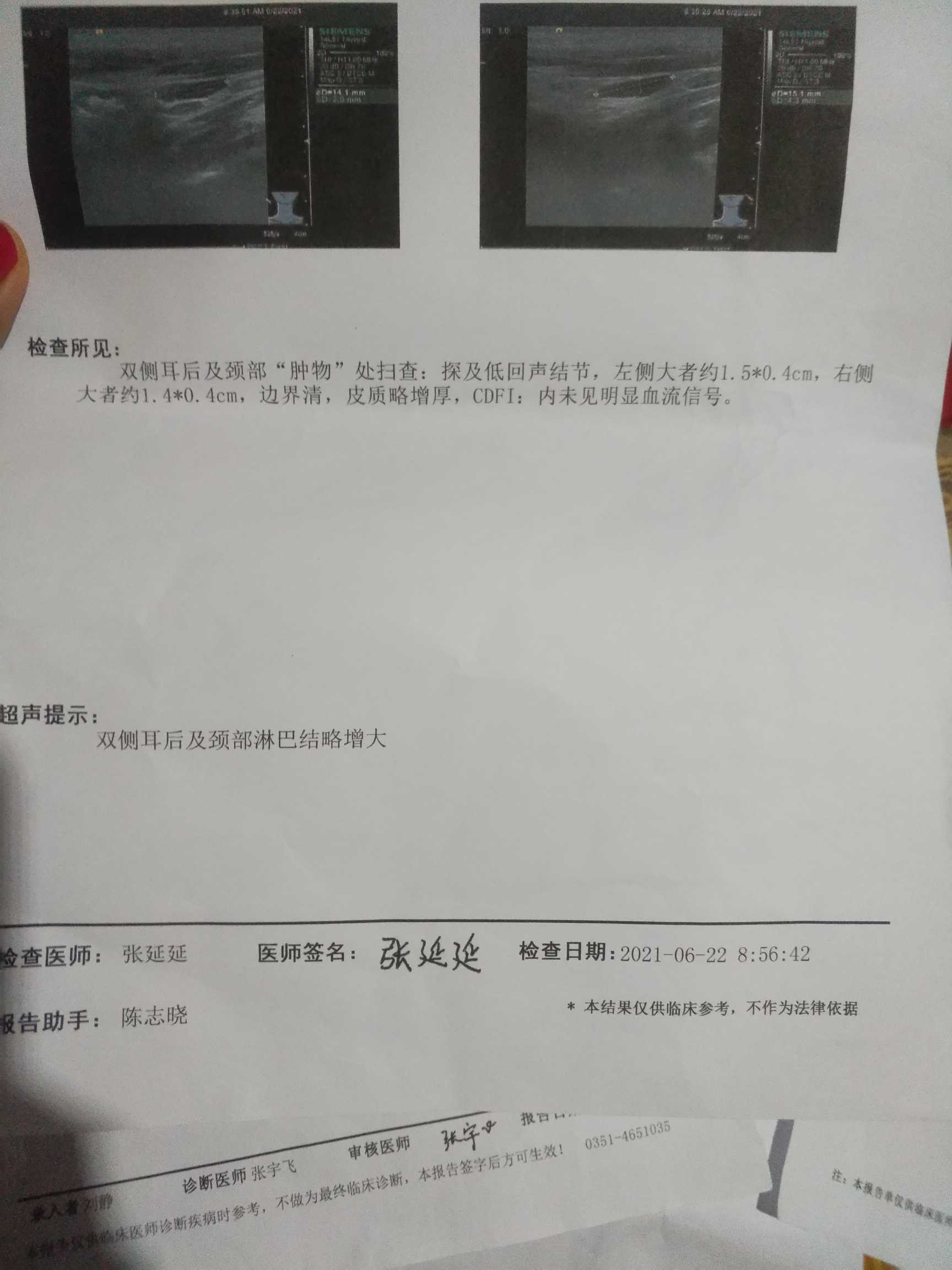 220938da2tdn94b9000t90.jpg