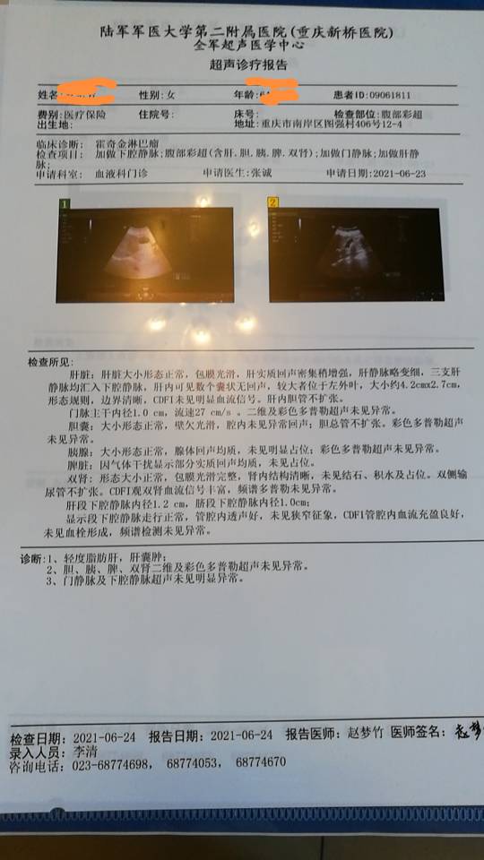 215627ufbimsctsg6sb6b5.jpg