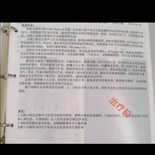 124304yxmei5s9tvx0twtf.jpg
