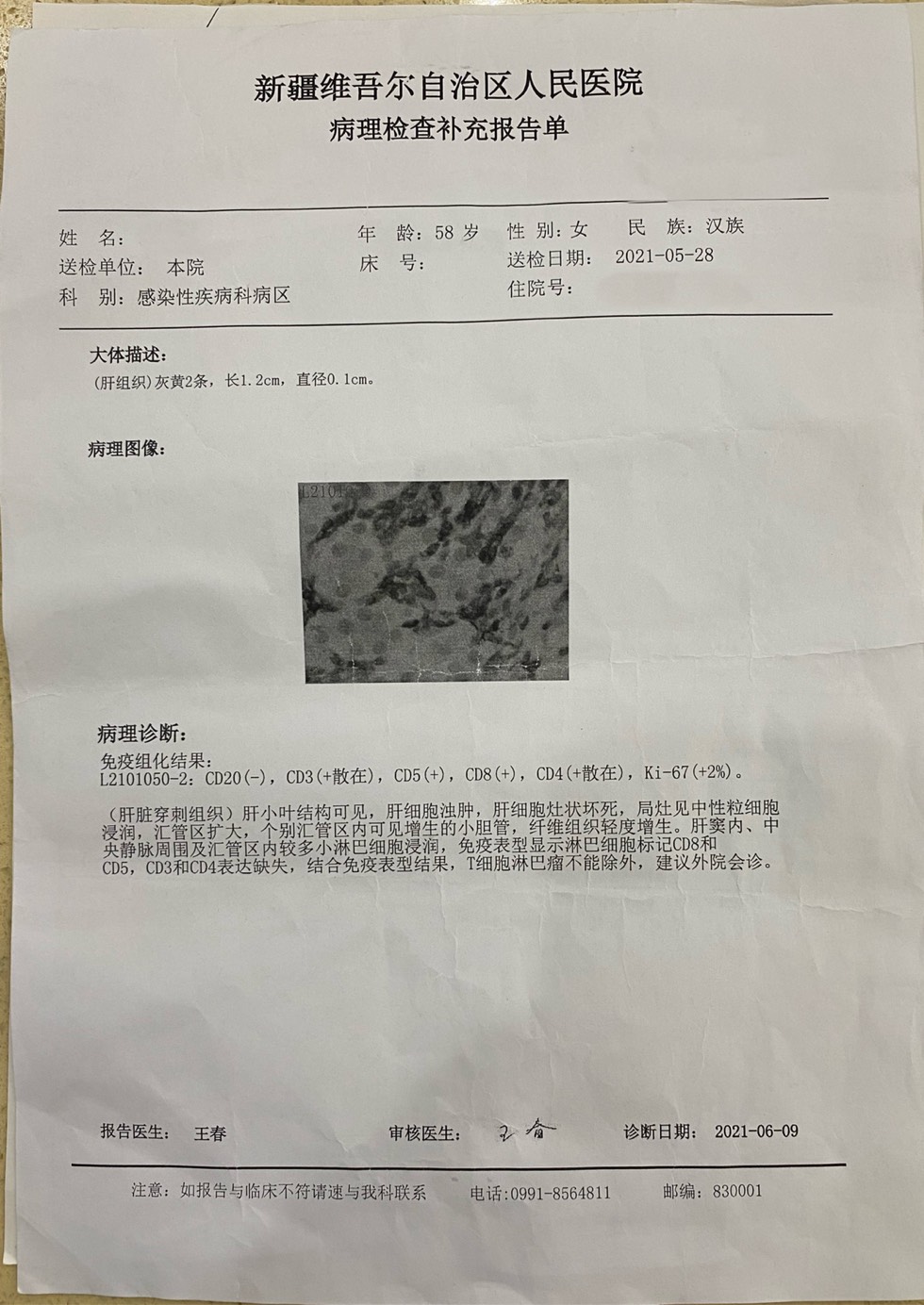115524kb5cm1iu5cv1fd8j.jpg