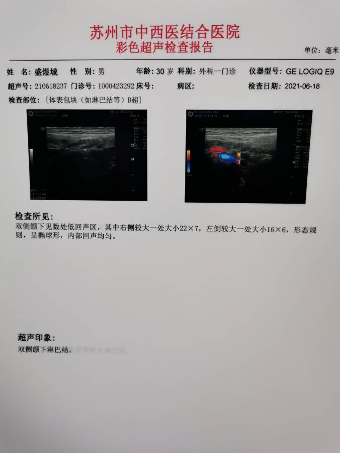 093120zxoaaizl6uus6asu.jpg