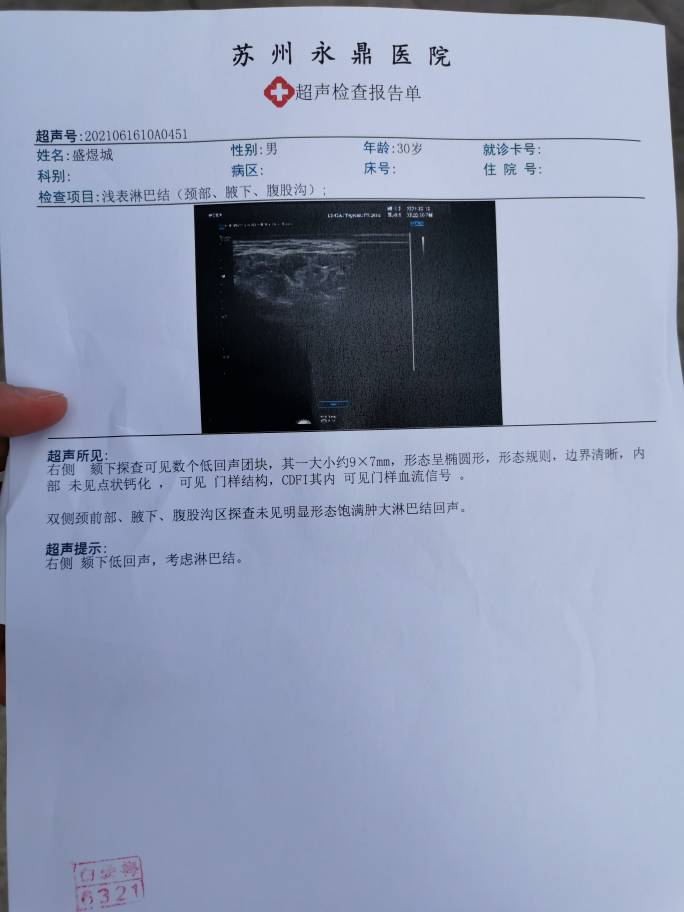 093121lxtmj7hm7xxffgmf.jpg