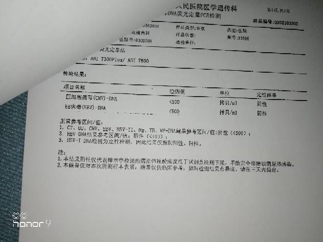 194907qrn1a18d6tdd1ob8.jpg