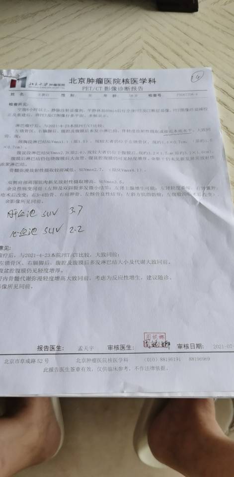 084219x6mmgl2u5lynu2pn.jpg