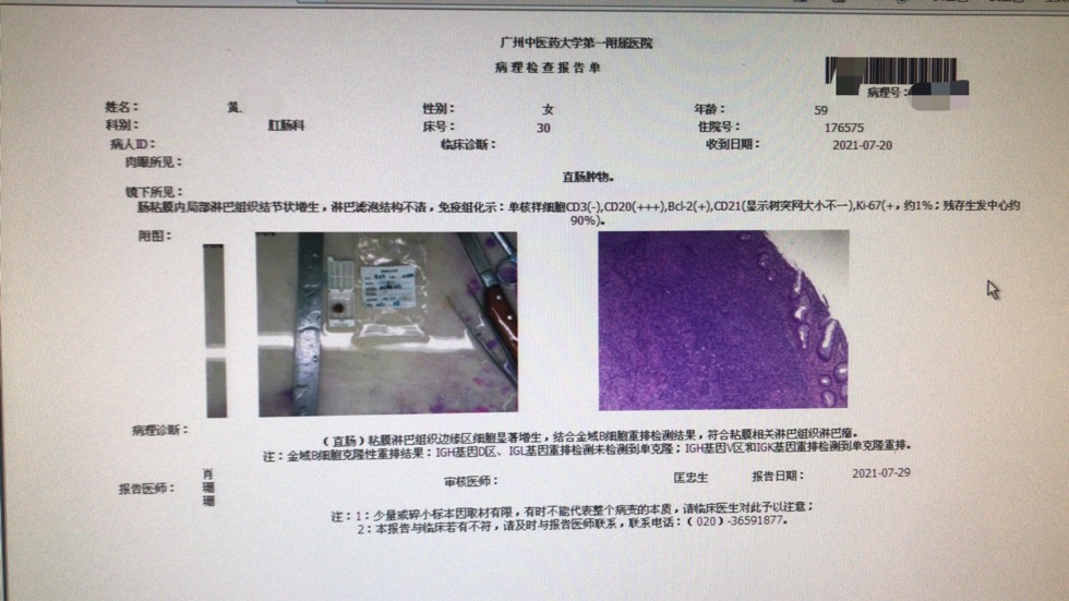 174228rc2cnczo27o6ggco.jpg