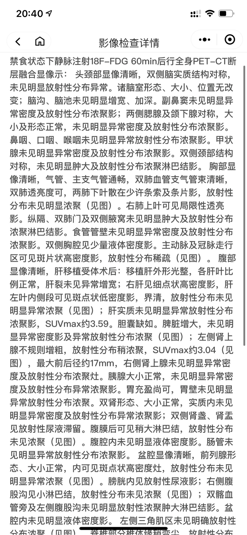 232754sm5hddqmqmxpdx57.jpg