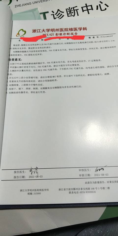 174109hkavpn43kp7nawdk.jpg