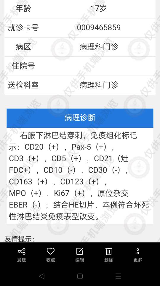 230257y80ccxbx5v4lpbvr.jpg