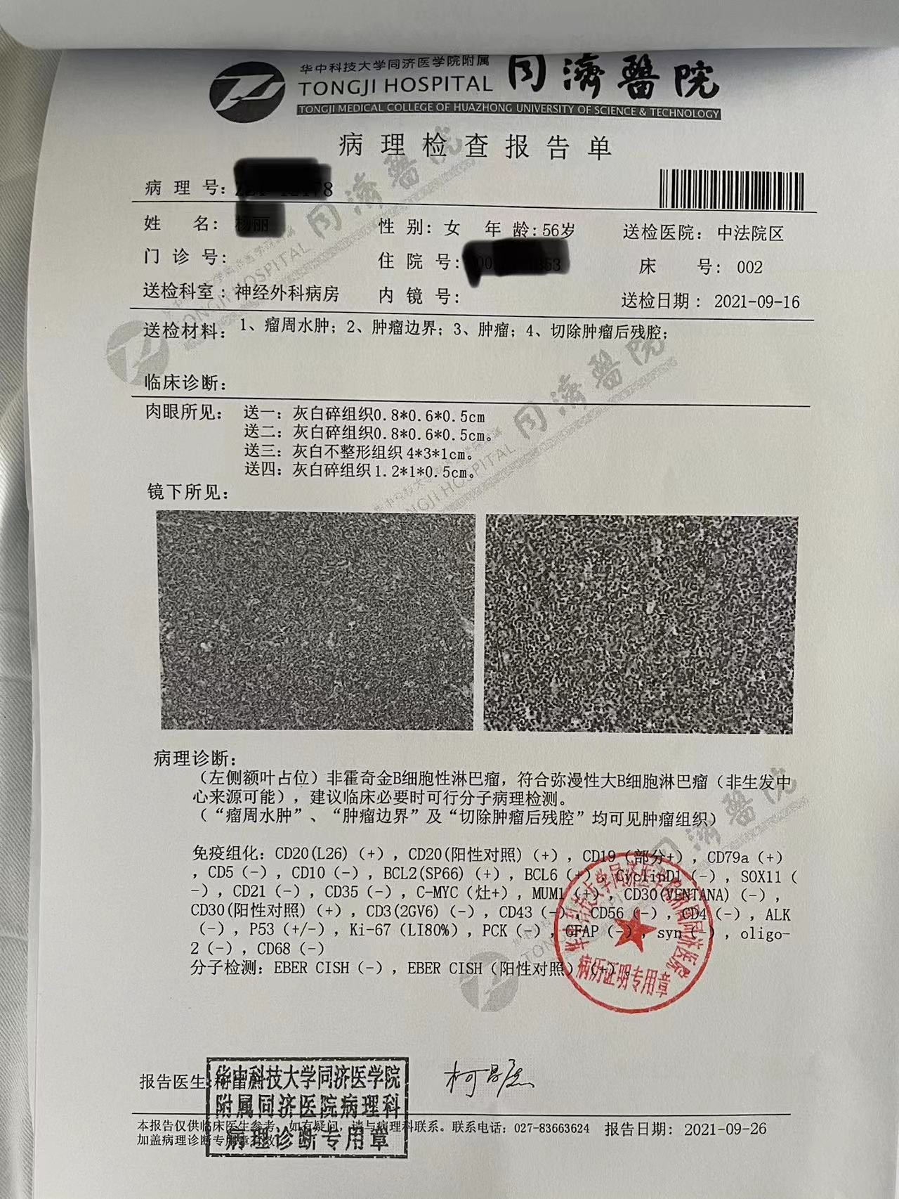 病理报告