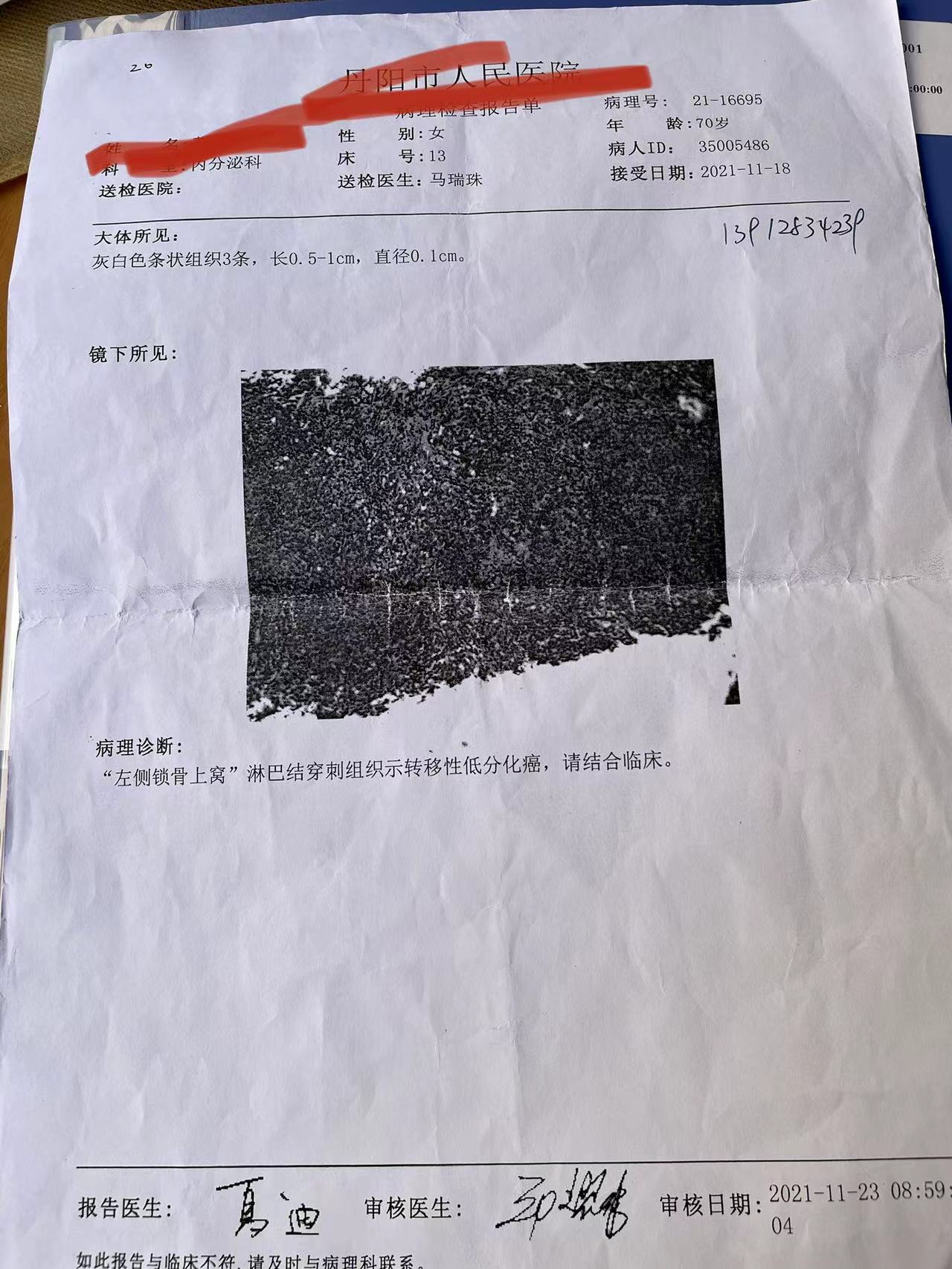病理为转移性低分化癌