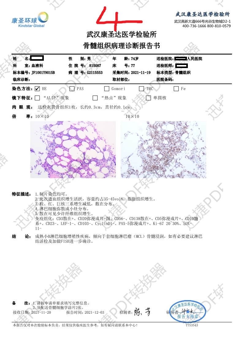 血液病理骨髓活检2