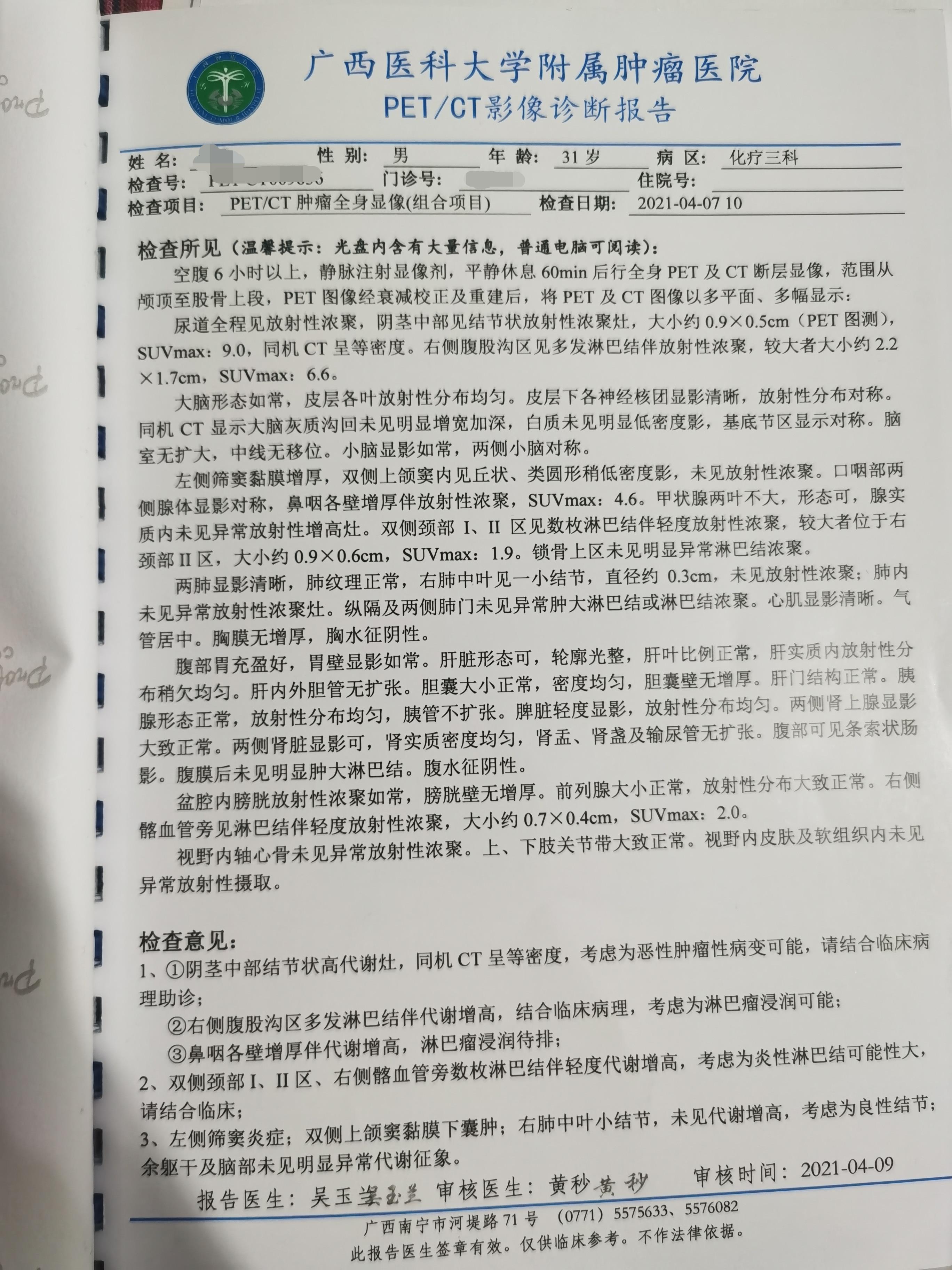 治疗前PERCT