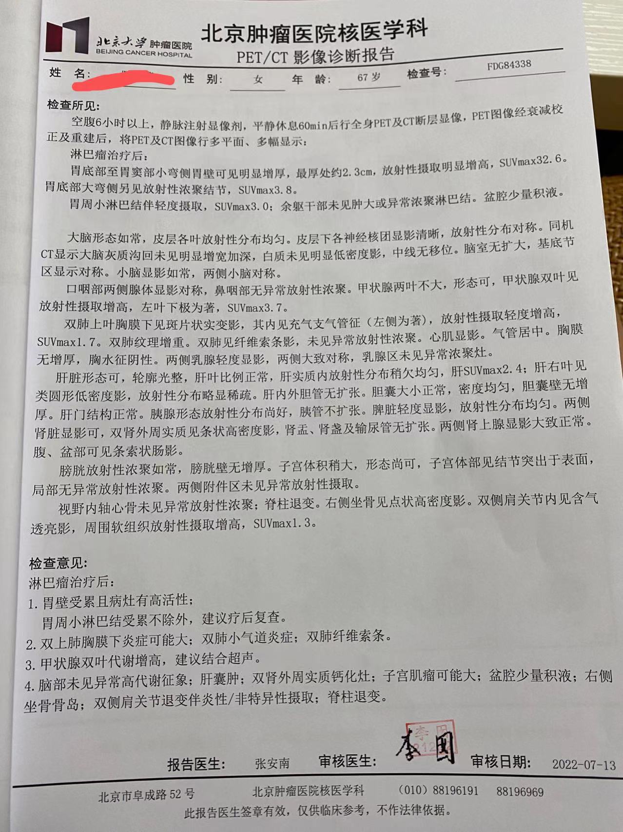 确诊前pet