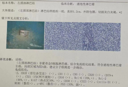 第一人民医院病理结果.png