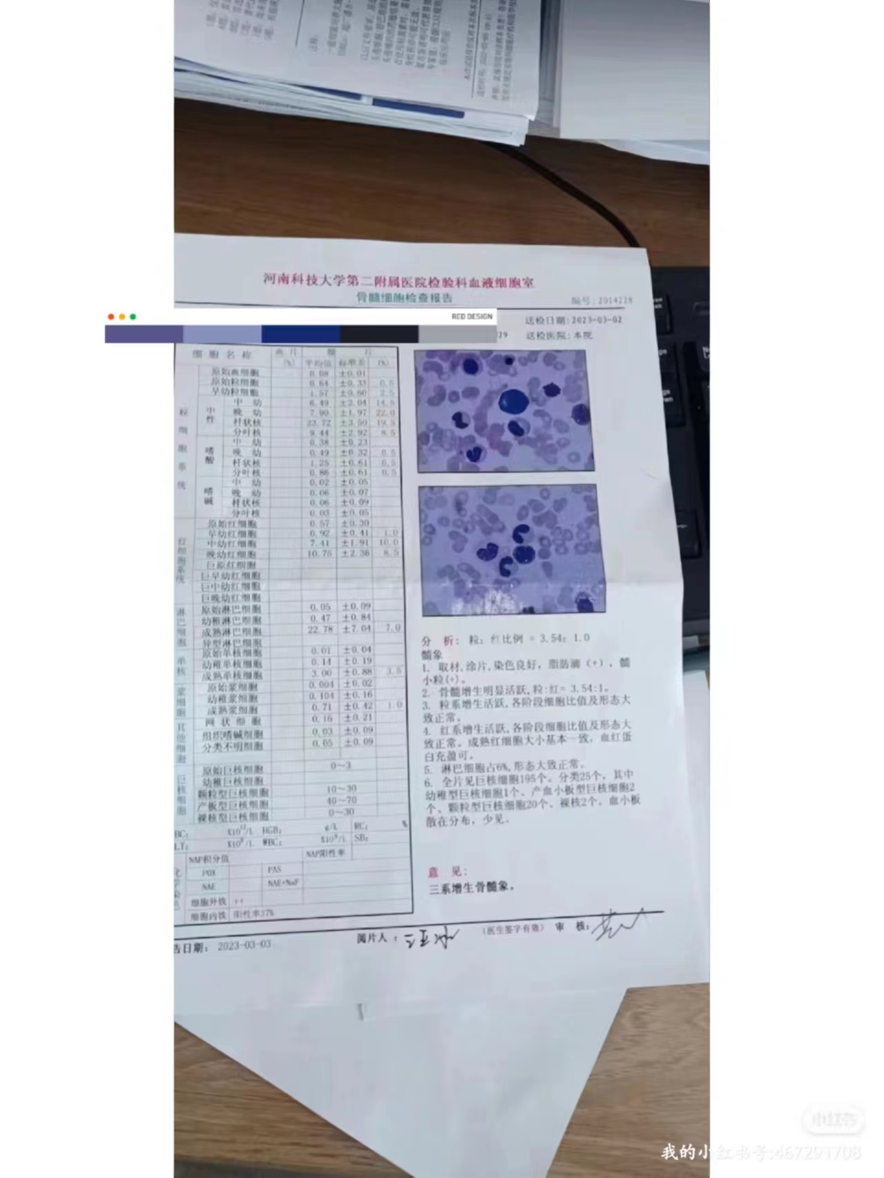 32436aa04e7c77ab793c6ce29244b32.jpg