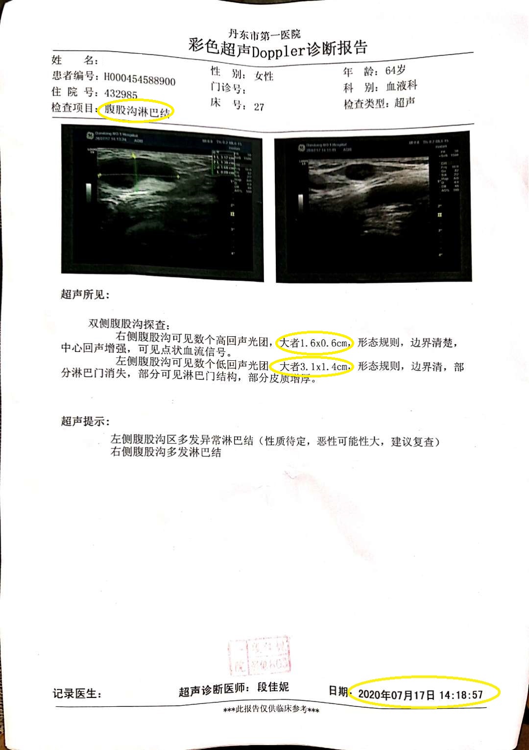 20年第一次检查腹股沟.jpg