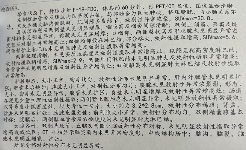 PET-CT