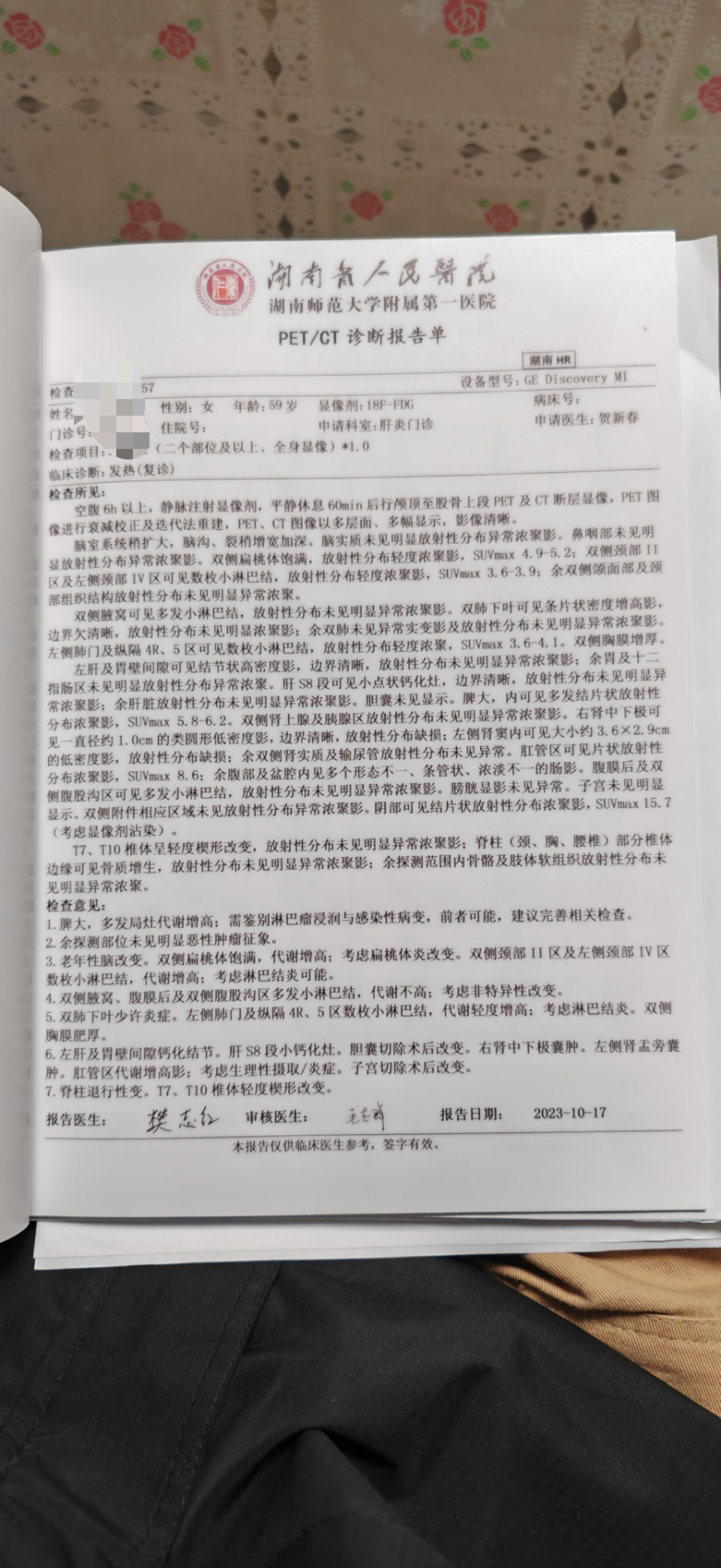 治疗前 pet-ct