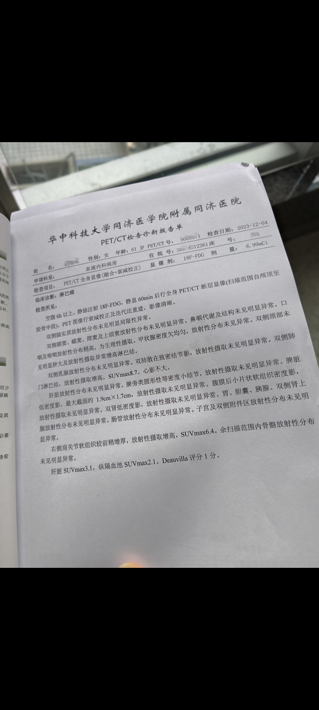 4疗后的