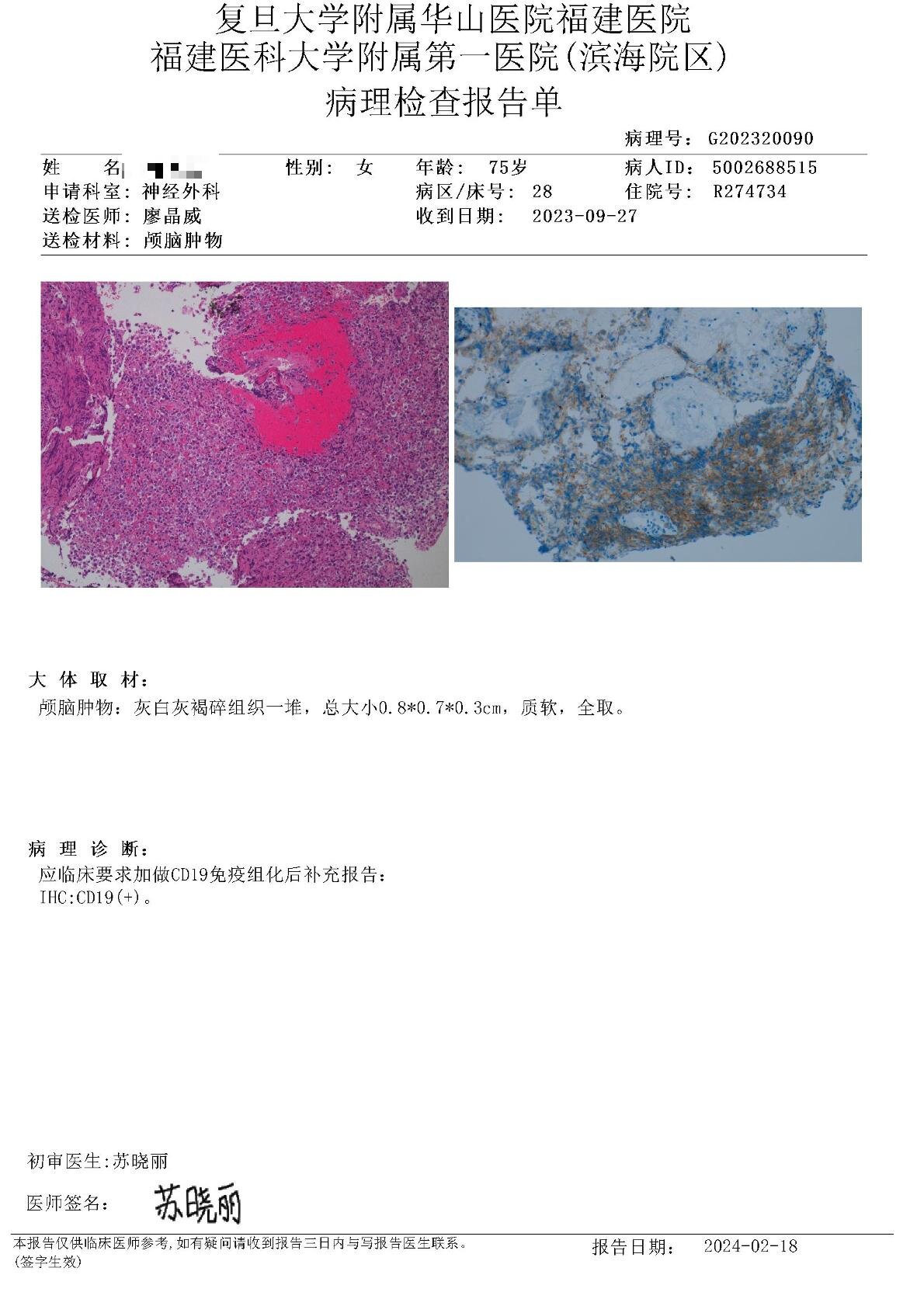 福医大附属第一医院补充CD19报告20240218.jpg