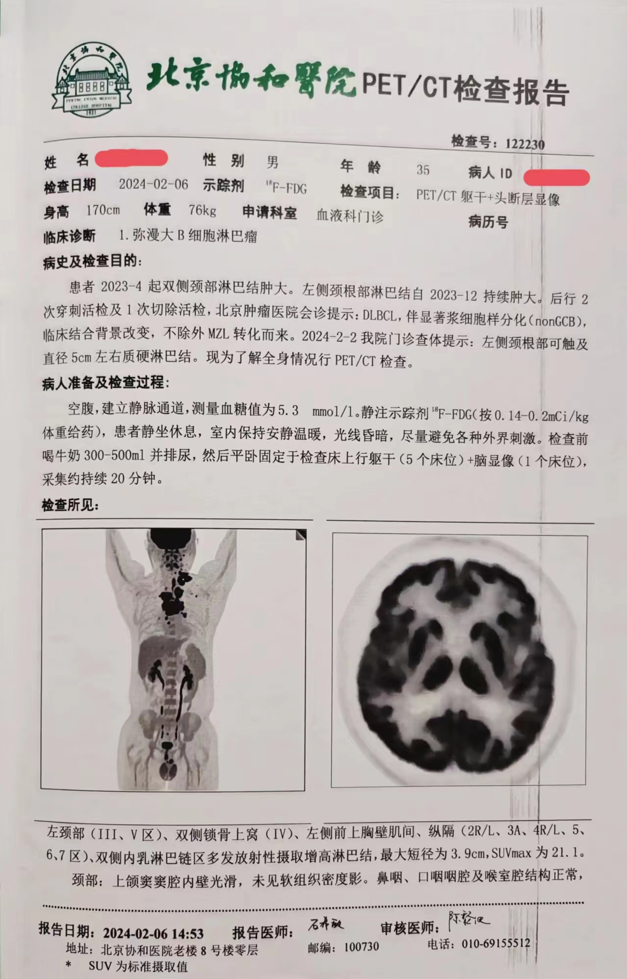 入院前检查