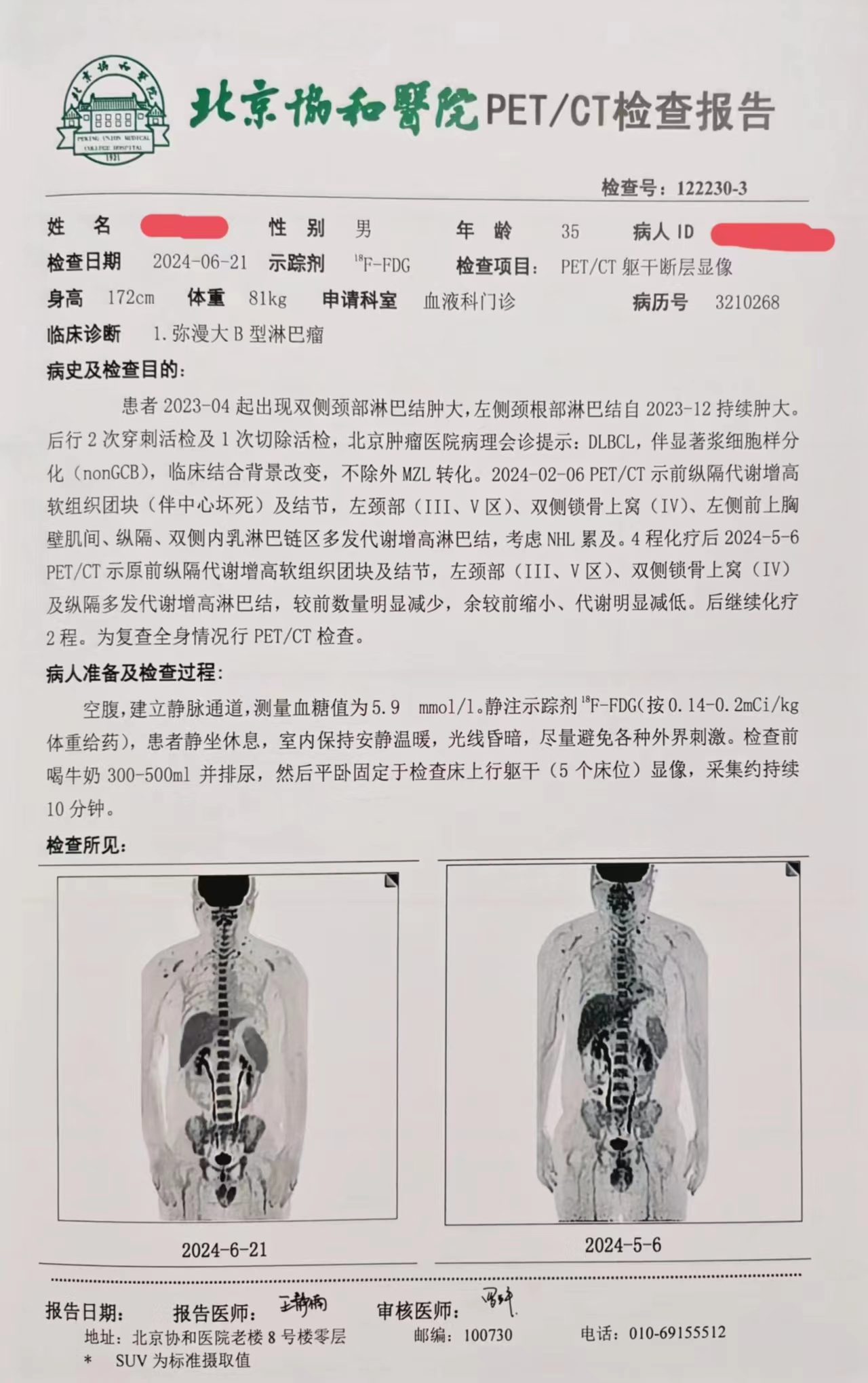 六疗后PETCT