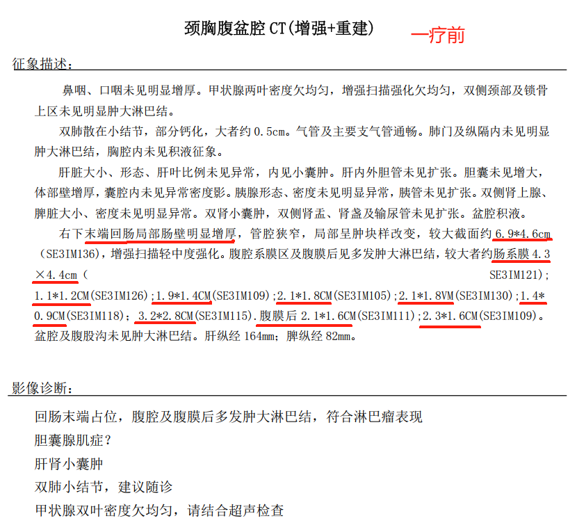一疗前增强CT.png