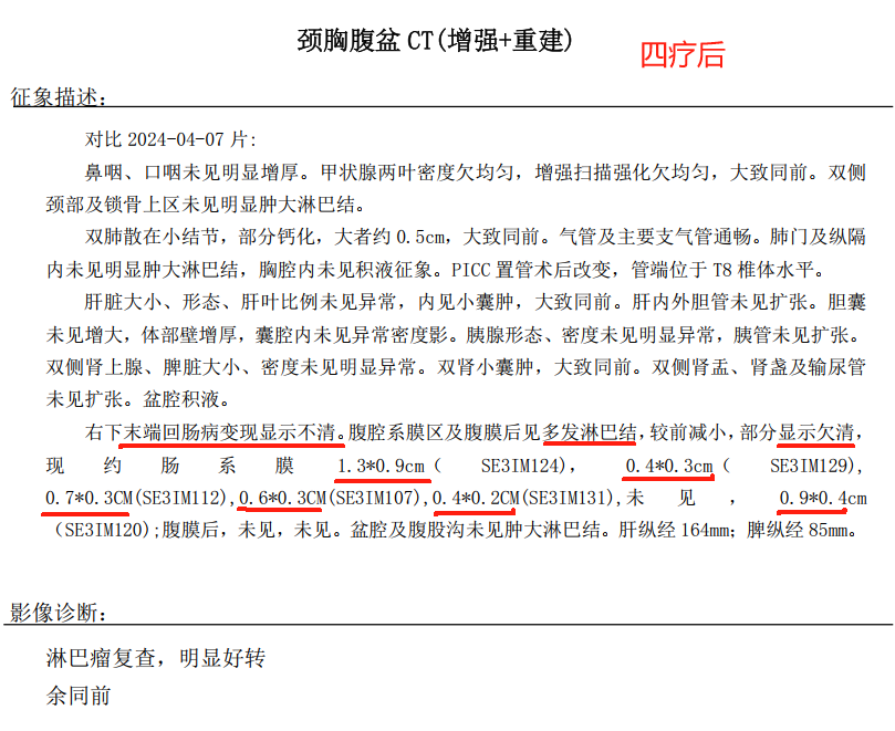 四疗后增强CT.png