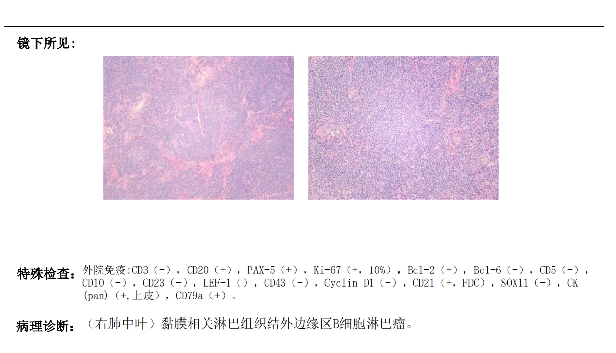 病理切片