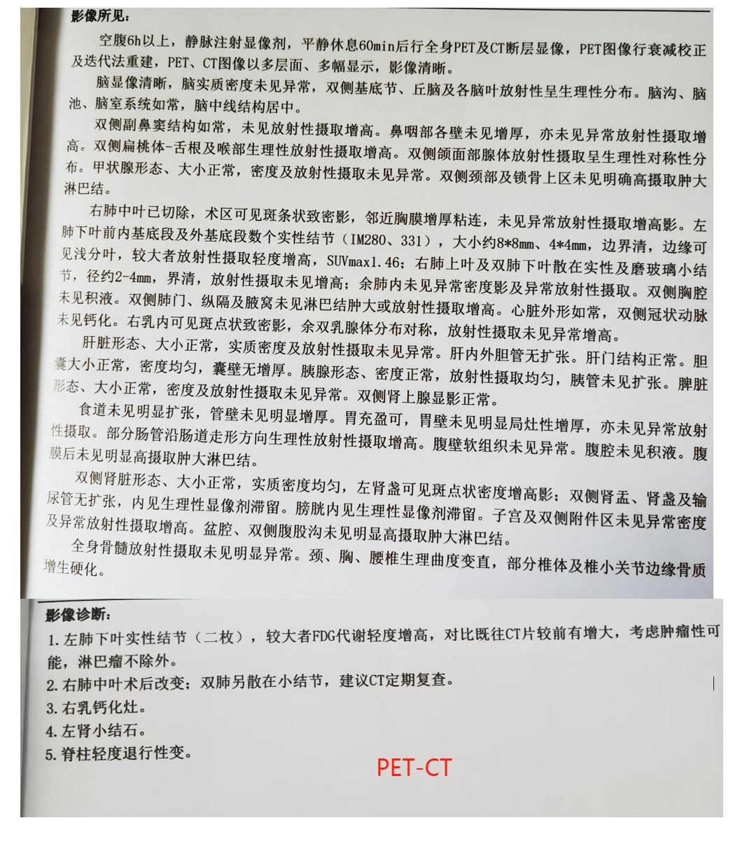 petct