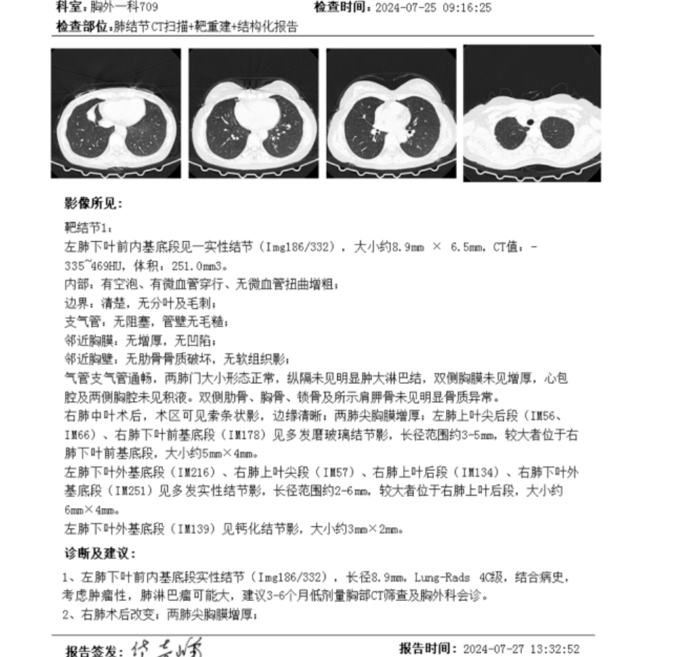增强CT