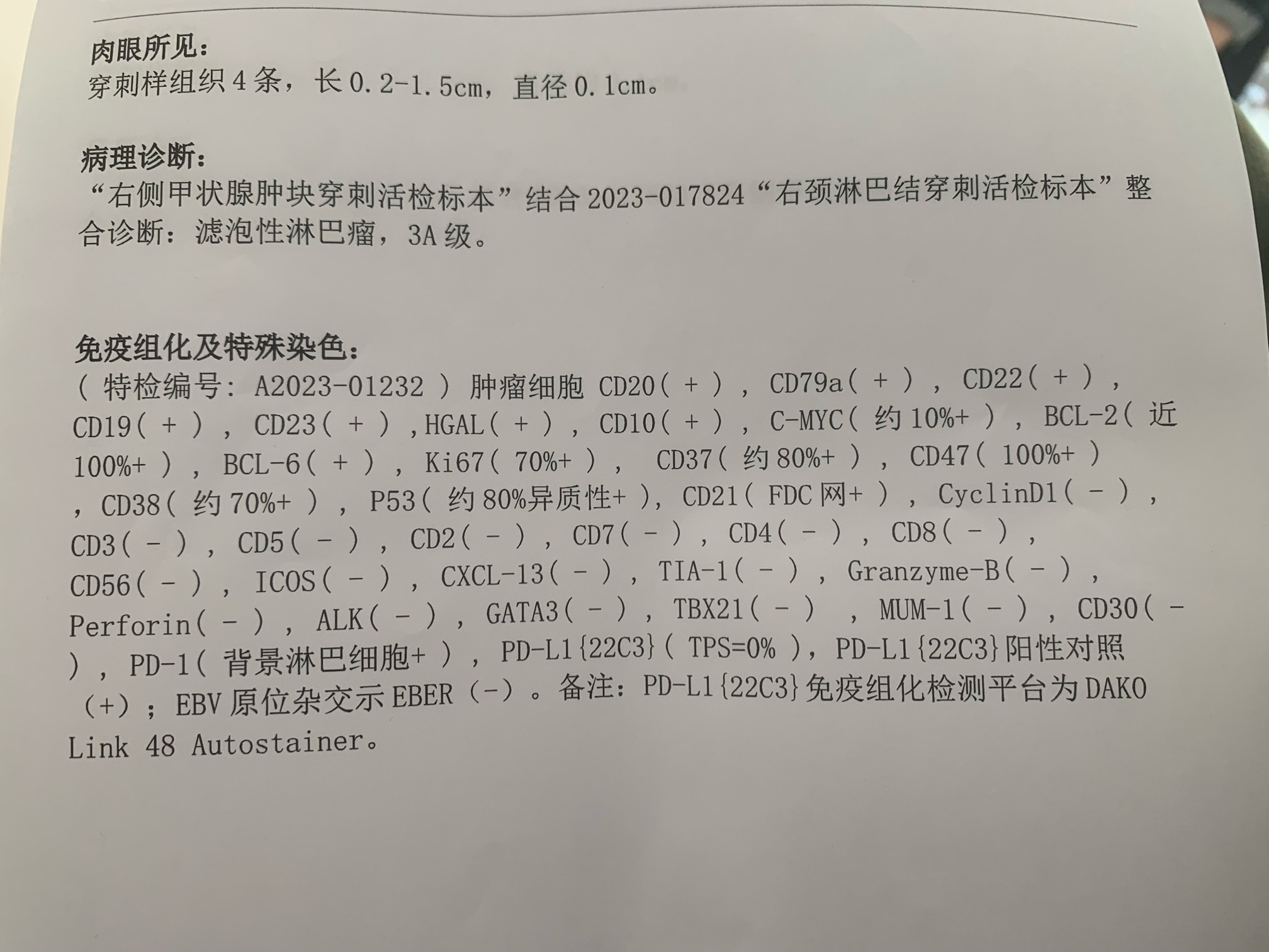 手术病理报告