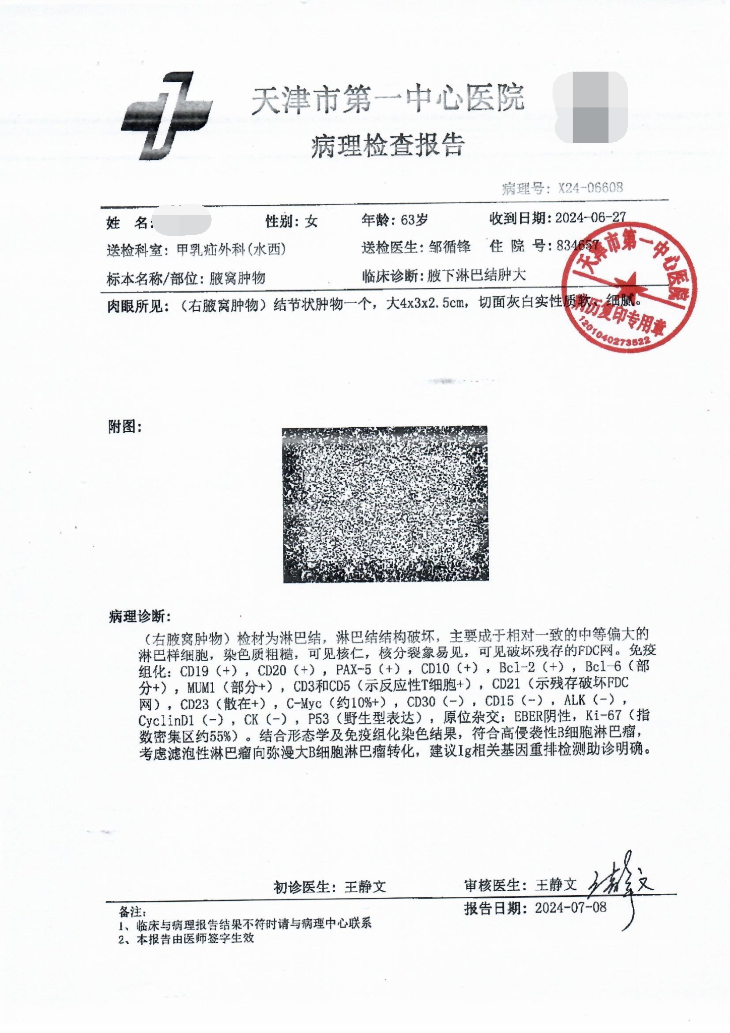 病理报告